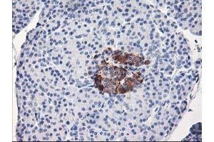 Immunohistochemical staining of paraffin-embedded Human pancreas tissue using anti-ACSS2 mouse monoclonal antibody. (ACSS2 antibody)