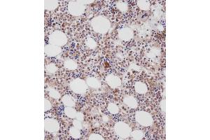 Immunohistochemical analysis of C on paraffin-embedded Human marrow tissue. (Cathepsin K antibody  (AA 207-237))