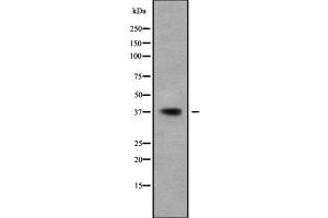 Western blot analysis of BCL2L14 using A549 whole cell lysates (BCL2L14 antibody  (N-Term))