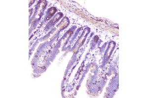 IHC analysis of RASAL1 using anti-RASAL1 antibody (ABIN6719367). (RASAL1 antibody  (AA 721-798))