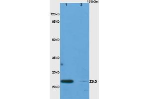 Lane 1: rat lung lysates Lane 2: rat pancreas lysates probed with Anti IL-17C Polyclonal Antibody, Unconjugated (ABIN747983) at 1:200 in 4 °C. (IL17C antibody  (AA 101-197))