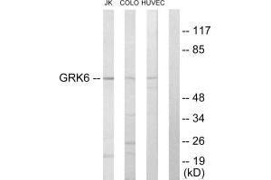 Western blot analysis of extracts from Jurkat cells, COLO205 cells and HUVEC cells, using GRK6 antibody. (GRK6 antibody  (N-Term))