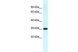 Image no. 1 for anti-Ribosomal Protein S4, Y-Linked 1 (RPS4Y1) (C-Term) antibody (ABIN6747705) (RPS4Y1 antibody  (C-Term))