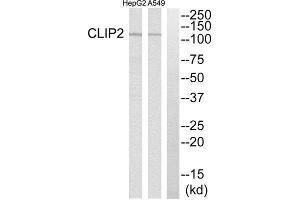 Western Blotting (WB) image for anti-CAP-GLY Domain Containing Linker Protein 2 (CLIP2) (C-Term) antibody (ABIN1850986) (CLIP2 antibody  (C-Term))