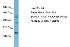 WB Suggested Anti-Fam19a4 Antibody   Titration: 1.
