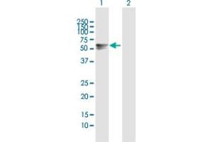 Western Blot analysis of ARSA expression in transfected 293T cell line by ARSA MaxPab polyclonal antibody. (Arylsulfatase A antibody  (AA 1-507))