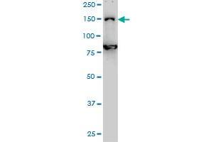 DHX8 monoclonal antibody (M01), clone 1E10 Western Blot analysis of DHX8 expression in Hela S3 NE .