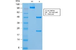 SDS-PAGE Analysis of Purified MUC18 Mouse Recombinant Monoclonal Antibody (rMUC18/1130).