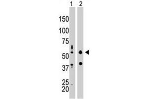 The EIF2AK2 polyclonal antibody  is used in Western blot to detect EIF2AK2 in mouse liver tissue lysate (Lane 1) and HepG2 cell lysate (Lane 2) . (EIF2AK2 antibody  (N-Term))