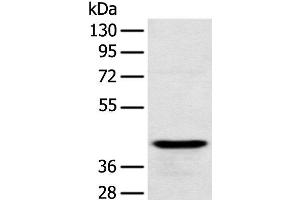 Western blot analysis of Human testis tissue using RSPH1 Polyclonal Antibody at dilution of 1:250 (RSPH1 antibody)