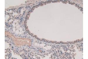 Immunohistochemistry (IHC) image for anti-Glutathione S-Transferase mu 1 (GSTM1) (AA 1-218) antibody (ABIN7436879)