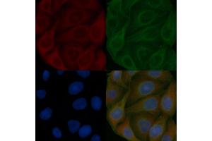 TFG Mouse Monoclonal Antibody staining Hela cells by IF/ICC.