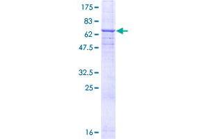 Image no. 1 for CD46 (CD46) (AA 1-384) protein (GST tag) (ABIN1348656) (CD46 Protein (CD46) (AA 1-384) (GST tag))