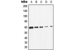 Western blot analysis of c-SRC expression in K562 (A), HeLa (B), MCF7 (C), HepG2 (D), mouse primary astrocytes (E) whole cell lysates. (Src antibody  (C-Term))