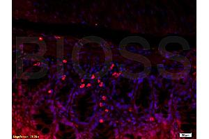 Formalin-fixed and paraffin embedded mouse kidney tissue labeled with Rabbit Anti-L-Selectin/CD62L Polyclonal Antibody (ABIN736716), Unconjugated 1:200 followed by conjugation to the secondary antibody and DAB staining (L-Selectin antibody  (AA 301-372))