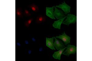 anti-Small Nuclear Ribonucleoprotein Polypeptide N (SNRPN) (Internal Region) antibody