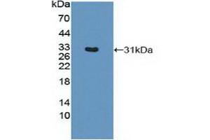 Western blot analysis of recombinant Mouse MHCDRb1. (HLA-DRB1 antibody  (AA 27-264))