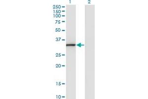 Western Blot analysis of ANXA3 expression in transfected 293T cell line by ANXA3 monoclonal antibody (M07), clone 1E2. (Annexin A3 antibody  (AA 1-323))