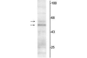 Western blot of rat hippocampal lysate showing specific immunolabeling of the ~50 kDa TR-α1 and the ~58 kDa TR-α2 protein. (THRA antibody  (N-Term))