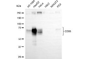 Western blotting analysis using CD55 antibody (ABIN7798142). (Recombinant CD55 antibody)