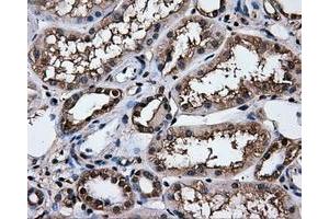 Immunohistochemical staining of paraffin-embedded Kidney tissue using anti-HSPA1Amouse monoclonal antibody. (HSP70 1A antibody)