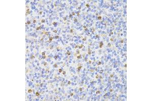 Immunohistochemistry of paraffin-embedded mouse spleen using HAVCR2 antibody (ABIN6291690) at dilution of 1:100 (40x lens).