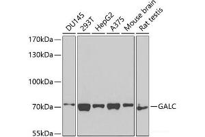 Western blot analysis of extracts of various cell lines using GALC Polyclonal Antibody at dilution of 1:1000. (GALC antibody)