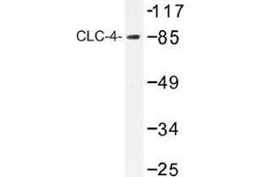 Image no. 1 for anti-Chloride Channel 4 (CLCN4) antibody (ABIN317826) (CLCN4 antibody)