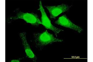 Immunofluorescence of monoclonal antibody to TOP3B on HeLa cell. (TOP3B antibody  (AA 1-862))