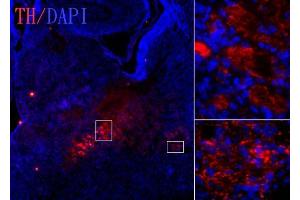 IHC-Fr Image Tyrosine hydroxylase antibody [N1C1] detects tyrosine hydroxylase protein on embryonic mouse brain by immunohistochemical analysis. (Tyrosine Hydroxylase antibody)