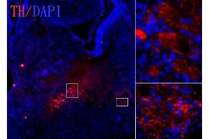 IHC-Fr Image Tyrosine hydroxylase antibody [N1C1] detects tyrosine hydroxylase protein on embryonic mouse brain by immunohistochemical analysis. (Tyrosine Hydroxylase antibody)