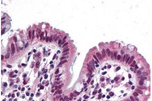 Human Colon: Formalin-Fixed, Paraffin-Embedded (FFPE) (SMARCB1 antibody  (AA 81-181))