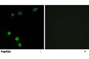 Immunofluorescence analysis of MCF-7 cells, using TP53INP2 polyclonal antibody .