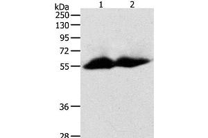 Western Blot analysis of Human colon and ovarian cancer tissue using MMP11 Polyclonal Antibody at dilution of 1:600 (MMP11 antibody)