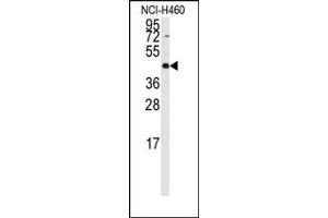Image no. 1 for anti-Required For Meiotic Nuclear Division 5 Homolog B (RMND5B) (C-Term) antibody (ABIN357964) (RMND5B antibody  (C-Term))