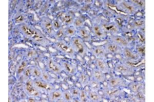 IHC analysis of IGF1 Receptor using anti-IGF1 Receptor antibody . (IGF1R antibody  (AA 31-257))