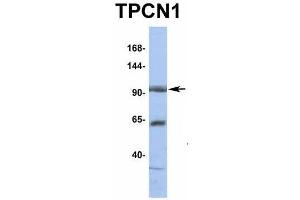 Host:  Rabbit  Target Name:  TPCN1  Sample Type:  HT1080  Antibody Dilution:  1. (TPCN1 antibody  (N-Term))