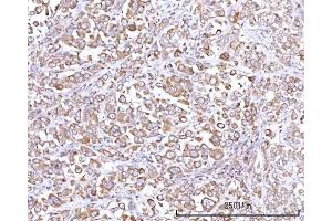 IHC analysis of RPN1 using anti-RPN1 antibody (ABIN7600447). (RPN1 antibody  (AA 196-495))