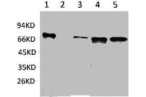 Western blot analysis of 1) Hela, 2) Jurkat, 3) Mouse Brain, 4) Mouse Kidney, 5) Rat Brain using ZBTB45 Polyclonal Antibody. (ZBTB45 antibody)