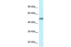 Western Blot showing CAMK2D antibody used at a concentration of 1 ug/ml against HT1080 Cell Lysate (CAMK2D antibody  (C-Term))
