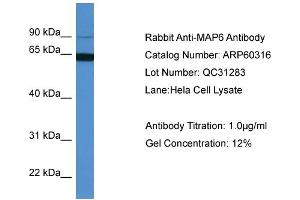 WB Suggested Anti-MAP6  Antibody Titration: 0. (MAP6 antibody  (N-Term))
