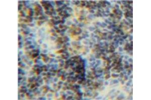 Used in DAB staining on fromalin fixed paraffin-embedded Spleen tissue (BID antibody  (AA 1-195))