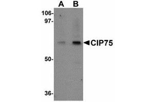 Image no. 1 for anti-Ubiquilin 4 (UBQLN4) (N-Term) antibody (ABIN478130) (UBQLN4 antibody  (N-Term))