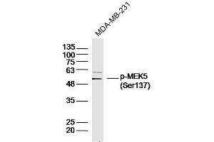Human MDA-MB-231 cells probed with MEK5(Ser137) Polyclonal Antibody, unconjugated  at 1:300 overnight at 4°C followed by a conjugated secondary antibody at 1:10000 for 90 minutes at 37°C.