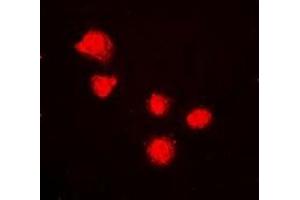 Immunofluorescent analysis of BMI1 staining in K562 cells.
