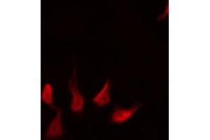 ABIN6267577 staining HepG2 by IF/ICC. (XIAP antibody  (pSer87))