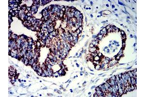 Immunohistochemistry (IHC) image for anti-Polymeric Immunoglobulin Receptor (PIGR) (AA 19-170) antibody (ABIN5684105)