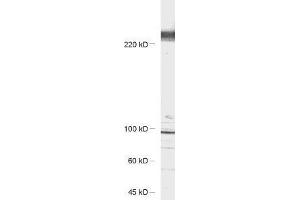 antibody dilution: 1 : 1000, sample: rat hippocampus lysate (CACNA1B antibody)