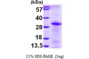 SDS-PAGE (SDS) image for Linker For Activation of T Cells Family, Member 2 (LAT2) (AA 27-243) protein (His tag) (ABIN666998) (LAT2 Protein (AA 27-243) (His tag))