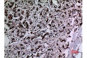 Immunohistochemistry (IHC) analysis of paraffin-embedded Human Breast, antibody was diluted at 1:100. (HSP90 antibody  (acLys284, acLys292))